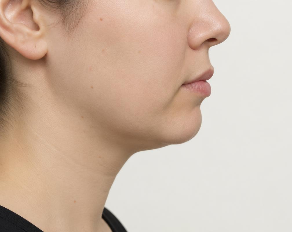 Jawline Definition before (AI example)