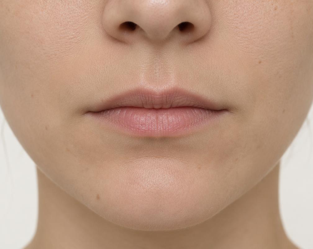 Lip Enhancement before (AI example)